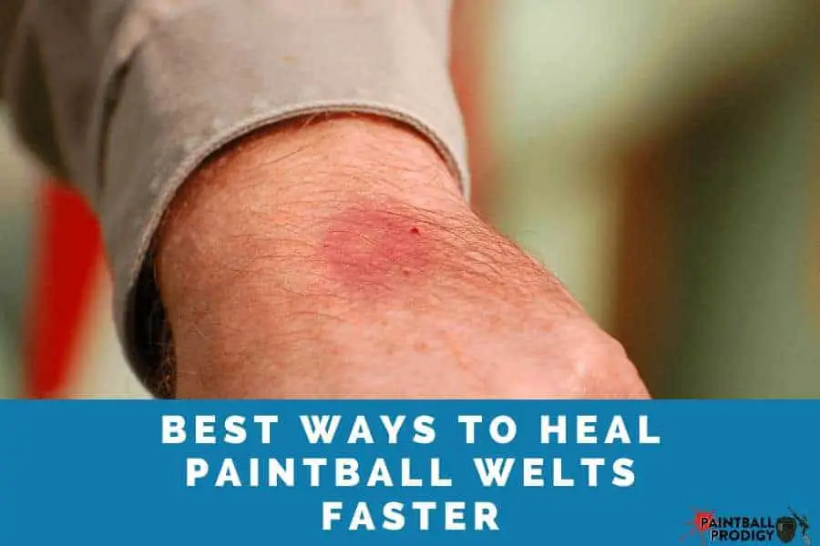 best way to heal paintball welts